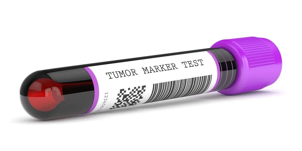 3d render of  blood sample with tumor marker test Illustrazione stock