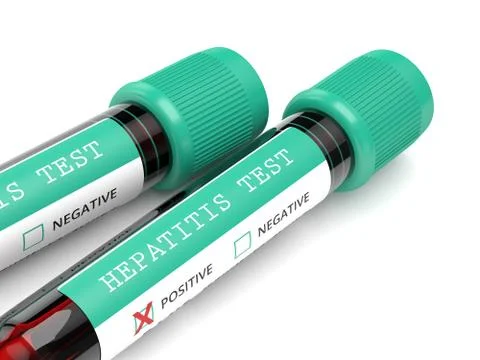 3d render of  blood samples with hepatitis test Illustrazione stock