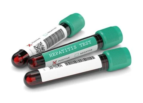 3d render of  blood samples with hepatitis test Illustrazione stock
