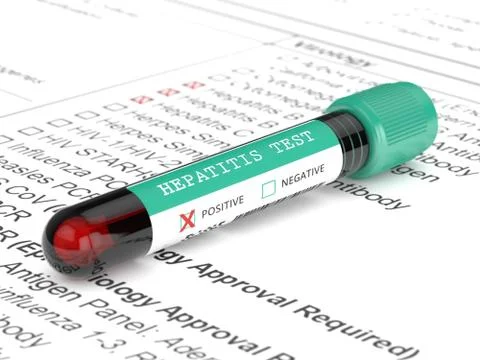 3d render of  blood samples with hepatitis test Illustrazione stock