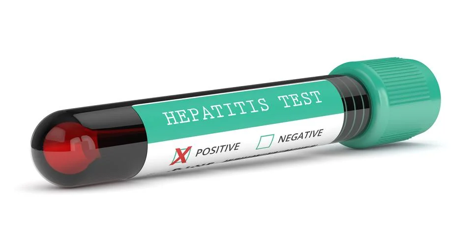 3d render of  blood samples with hepatitis test Illustrazione stock