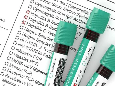 3d render of  blood samples with hepatitis test Illustrazione stock