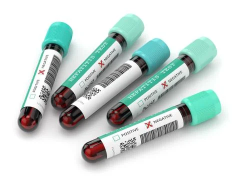 3d render of  blood samples with hepatitis test Stock Illustration