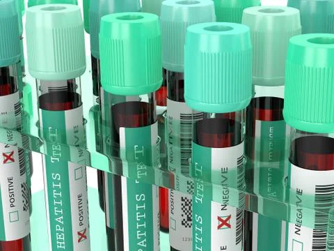 3d render of  blood samples with hepatitis test Illustrazione stock