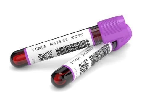 3d render of  blood samples with tumor marker test Illustrazione stock