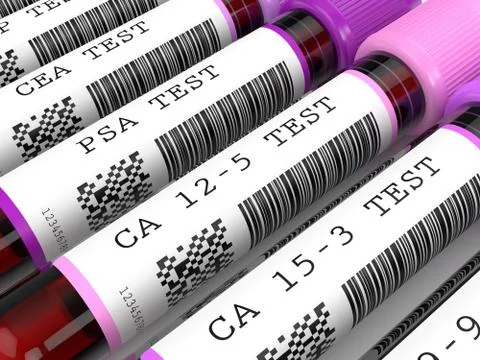 3d render of  blood samples with tumor markers test 스톡 일러스트