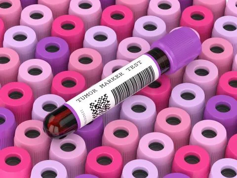 3d render of  blood samples with tumor marker test Illustrazione stock