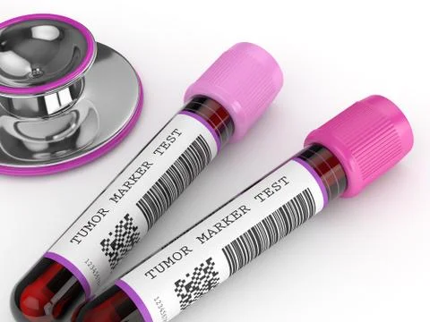 3d render of  blood samples with tumor markers test Illustrazione stock