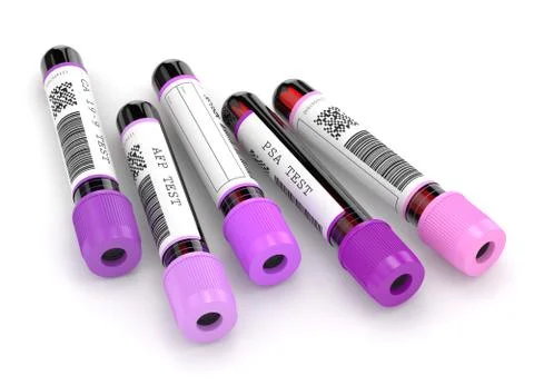 3d render of  blood samples with tumor markers test Illustrazione stock