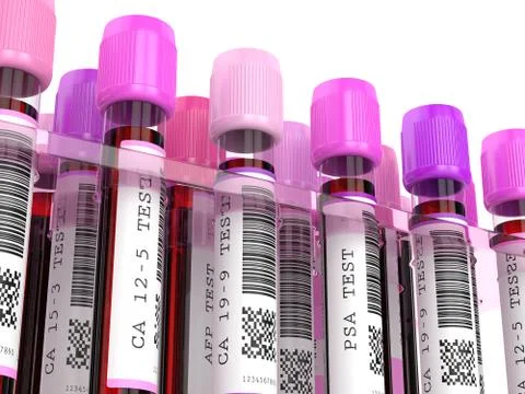 3d render of  blood samples with tumor markers test Stock Illustration