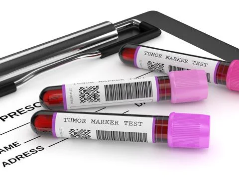 3d render of  blood samples with tumor markers test Illustrazione stock