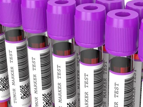3d render of  blood samples with tumor markers test Illustrazione stock