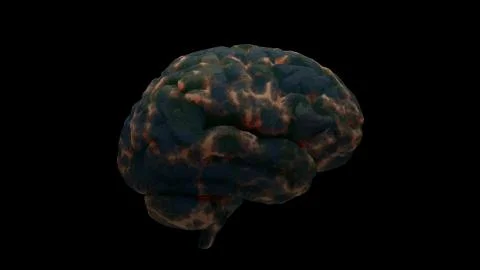 3d render of brain with damage zones. Infection or another reason of brain da Stock Illustration