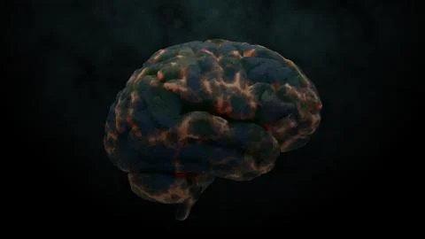 3d render of brain with damage zones. Infection or another reason of brain da Stock Illustration