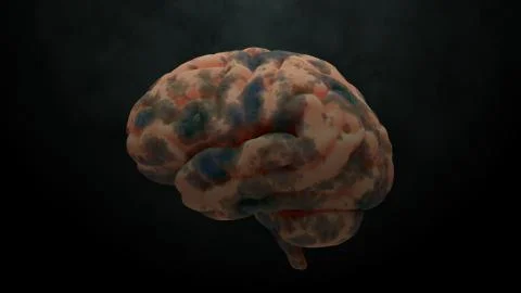 3d render of brain with damage zones. Infection or another reason of brain da Stock Illustration