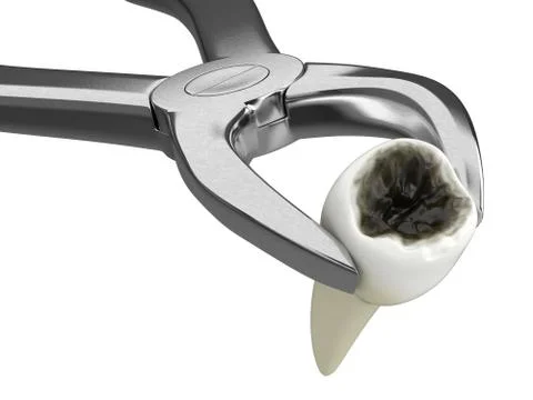 3d render of dental forceps extracting tooth with caries Stock Illustration