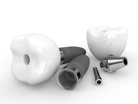 3d render of dental implants lying on table Stock Photos