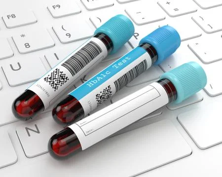 3d render of HbA1c blood tubes lying on computer keyboard イラスト素材