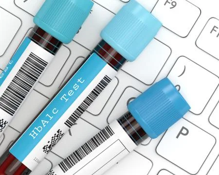 3d render of HbA1c blood tubes lying on computer keyboard Stock Illustration