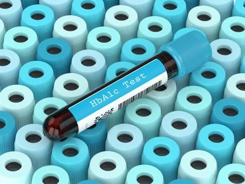 3d render of HbA1c blood tubes in row 스톡 일러스트