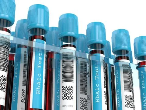 3d render of HbA1c blood tubes in rack イラスト素材