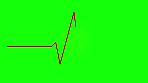 3D render of heartbeat line and romantic symbol on green screen background Stock Footage 336180066