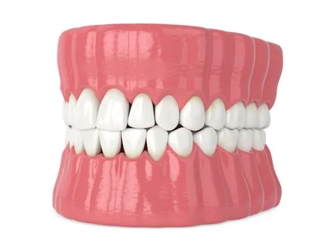 3d render of human jaw with black triangles Illustrazione stock