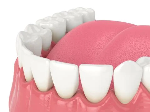 3d render of human lower jaw with black triangles Stock Illustration