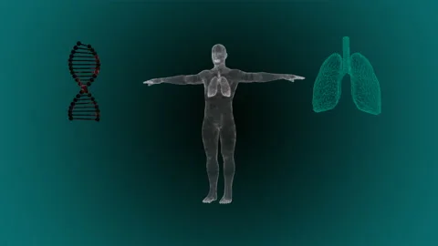 3d render of human lungs inflamed and infected by a disease like pneumonia or Stock Footage 130960475