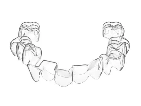 3d render of invisalign removable aligner Stock Illustration