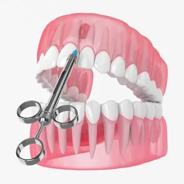 3d render of jaw and syringe with dental anesthesia Stock Photos