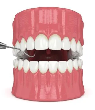3d render of jaw with dental explorer over white Illustrazione stock