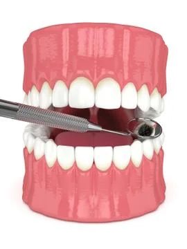 3d render of jaw with dental mirror Stock Illustration