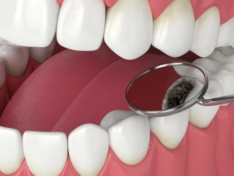 3d render of jaw with dental mirror Stock Illustration