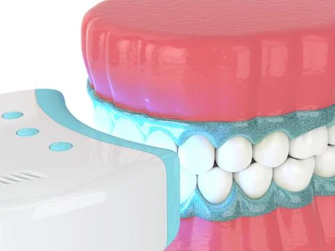 3d render of jaw with teeth bleaching by uv lamp Stock Illustration
