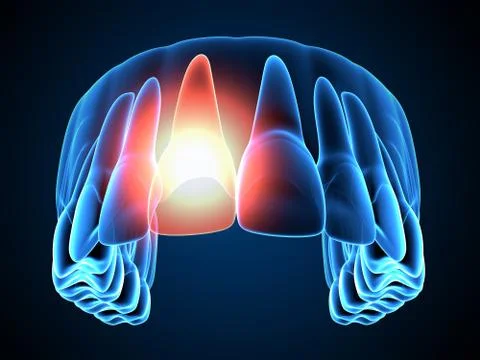 3d render of  jaw x-ray with throbbing toothache Stock Illustration
