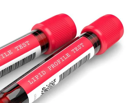 3d render with lipid profile test blood samples 스톡 사진
