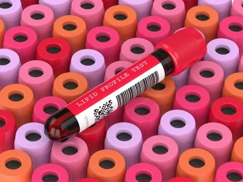 3d render with lipid profile test blood samples 写真素材