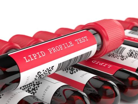 3d render with lipid profile test blood samples 写真素材