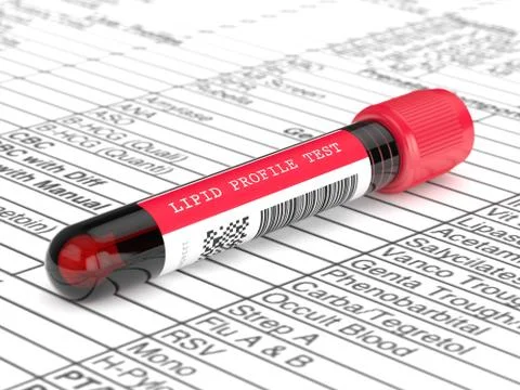 3d render with lipid profile test blood sample Stock Photos