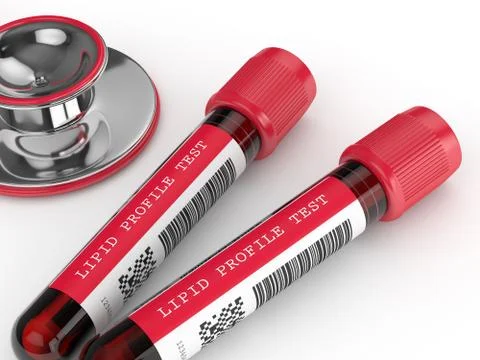 3d render with lipid profile test blood samples 写真素材