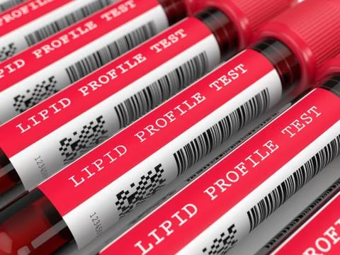 3d render with lipid profile test blood samples 스톡 사진