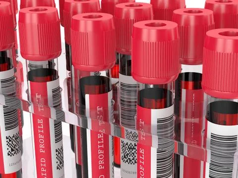 3d render with lipid profile test blood samples 写真素材