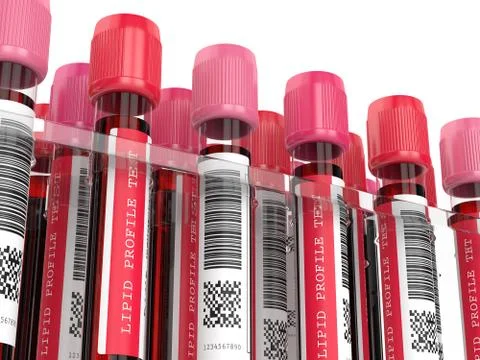 3d render with lipid profile test blood samples Stock Photos
