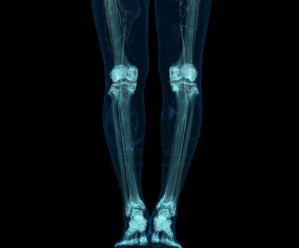 3D render of lower extremity or legs isolated on black background. Stock Illustration