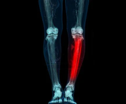 3D render of lower extremity or legs isolated on black background. Stock Illustration
