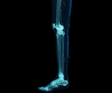 3D render of lower extremity or legs isolated on black background. Stock Illustration