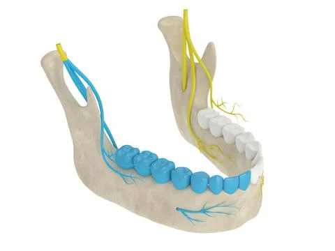 3d render of mandibular arch with gow-gates nerve block Stock Illustration