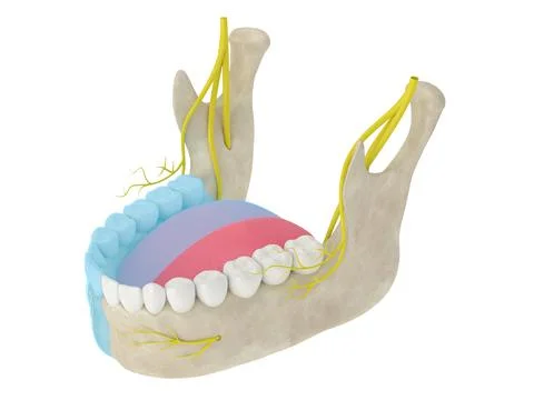 3d render of mandibular arch showing blocked inferior alveolar nerve  area Stock Illustration
