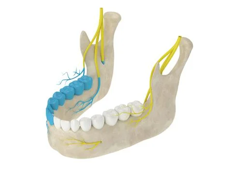 3d render of mandibular arch showing blocked inferior alveolar nerve  area Illustrazione stock